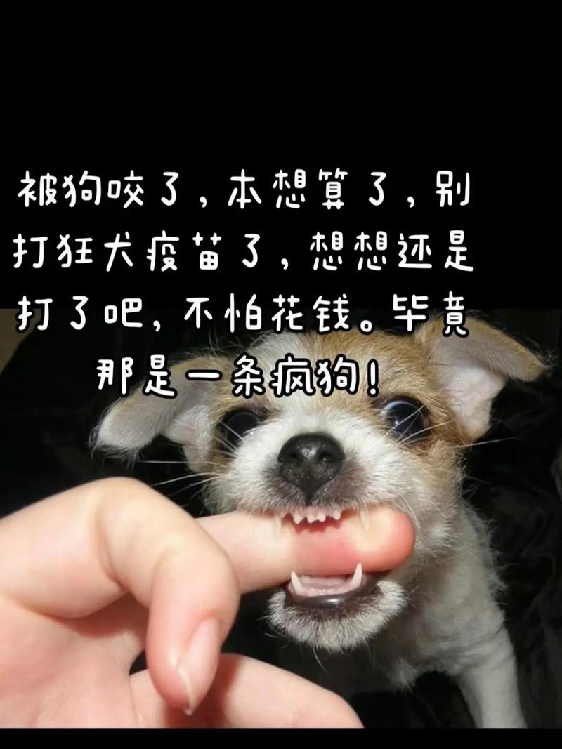 人咬狗才是新闻(人咬狗才是新闻是谁说的)-第3张图片-华田资讯 人咬狗才是新闻(人咬狗才是新闻是谁说的)-第3张图片-华田资讯