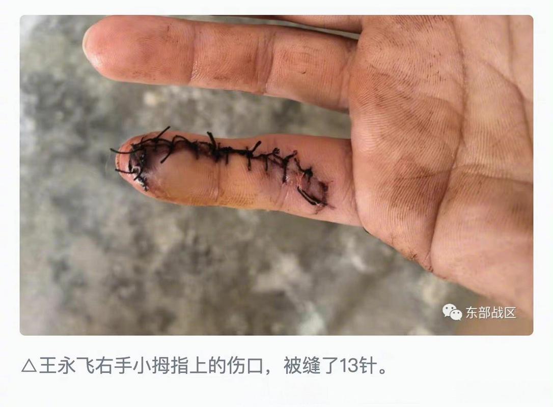 拇指巢湖最新新闻(下载拇指巢湖)-第6张图片-华田资讯 拇指巢湖最新新闻(下载拇指巢湖)-第6张图片-华田资讯