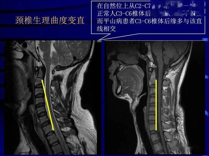 平山网平山新闻(平山县新闻网)-第1张图片-华田资讯 平山网平山新闻(平山县新闻网)-第1张图片-华田资讯